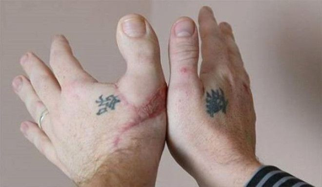6 köklü diş dişçilerin kabusu oldu!