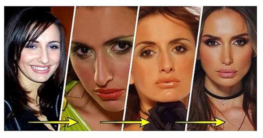 'Ufak tefek' dokunuşlarla bambaşka olan ünlüler!