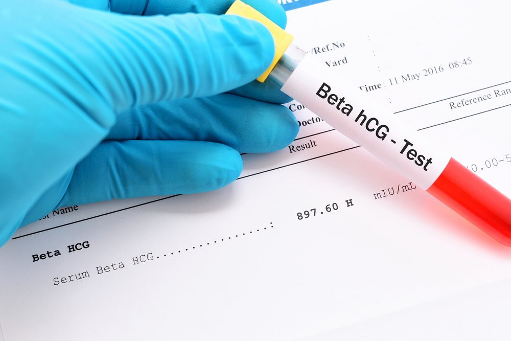 Beta HCG hormonu nedir? Beta HCG testi niçin yapılır? Hamilelik nasıl anlaşılır?