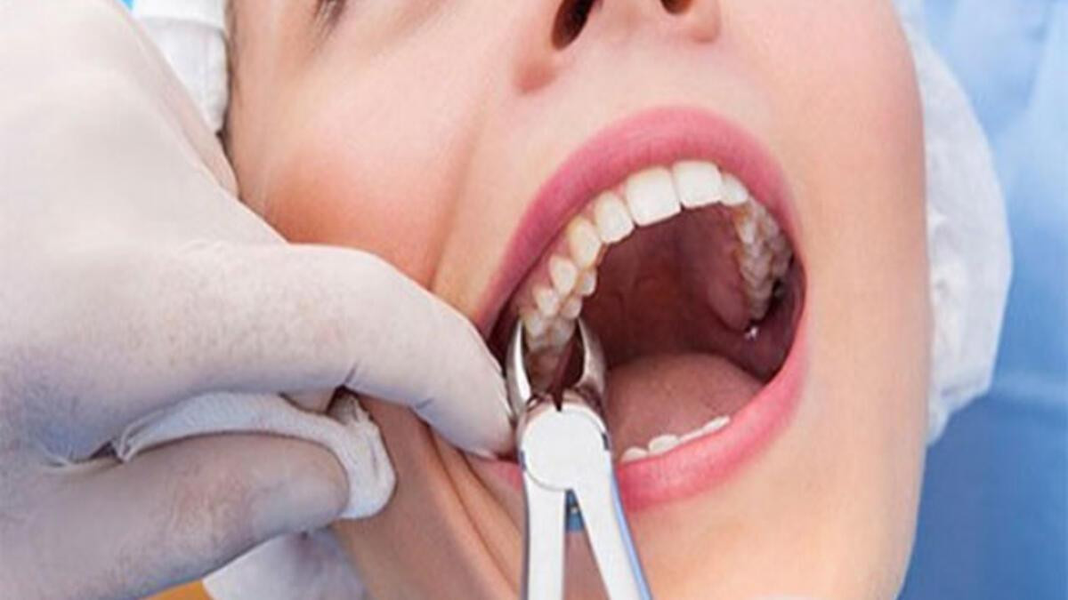 20'lik diş ağrısına ne iyi gelir? - Sağlık Haberleri