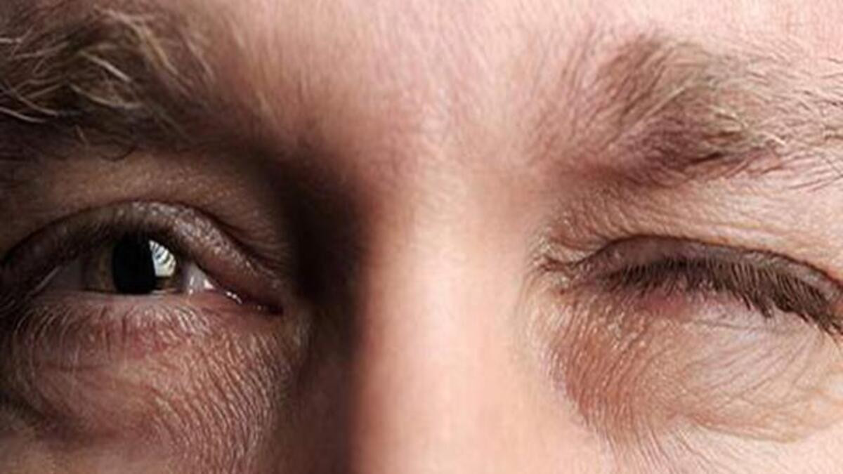 Göz seyirmesi neden olur, gözler neden seğirir? Sağ sol göz seğirmesi  nedenleri ve gözde atma hissinin sebepleri - Püf Noktası