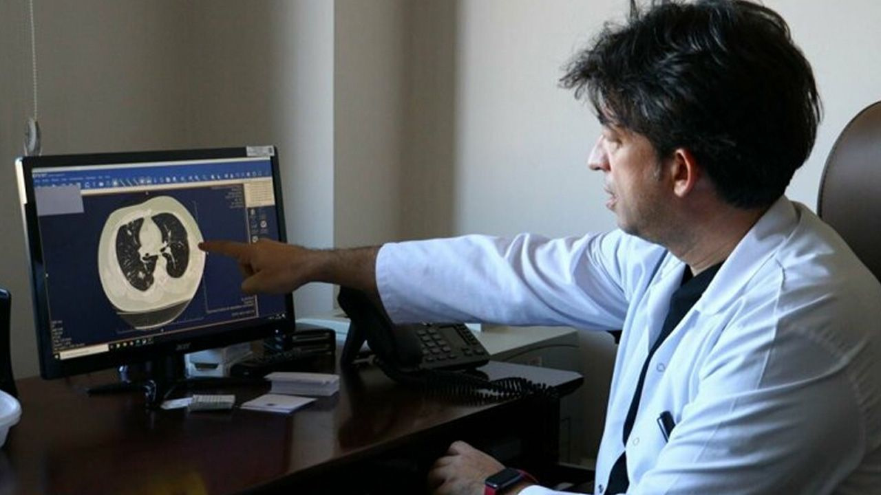 Doç. Dr. Taşçı: Kovid-19 akciğerdeki solunum keseciklerinde hasara yol açıyor