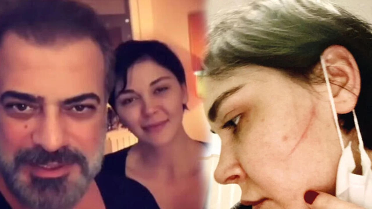 Sevcan Yaşar: Sermiyan Midyat dövüp çıplak videomu çekti!