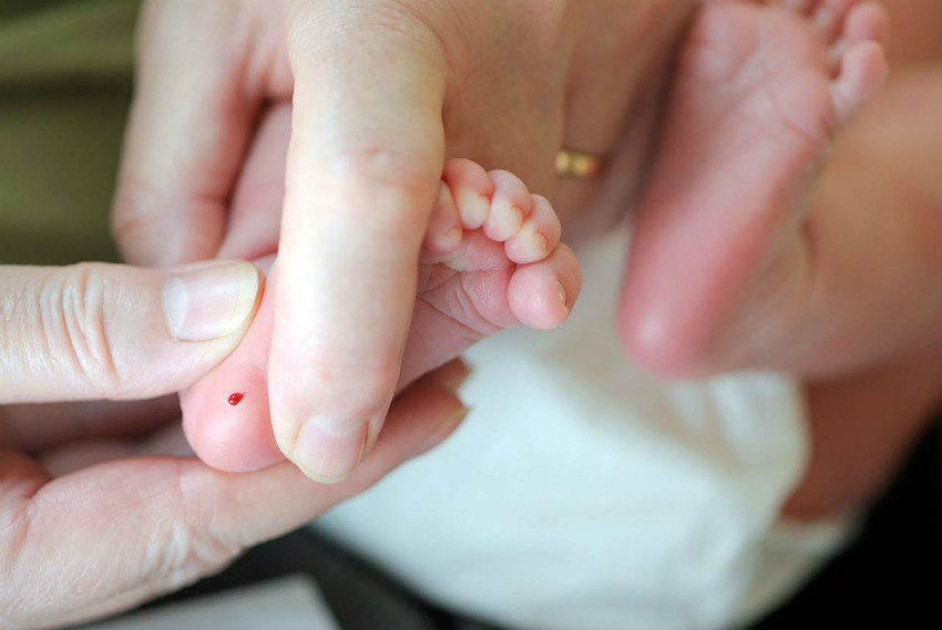 Bebeklerde Topuk Kanı Ne Zaman, Neden Alınır? | Anneysen