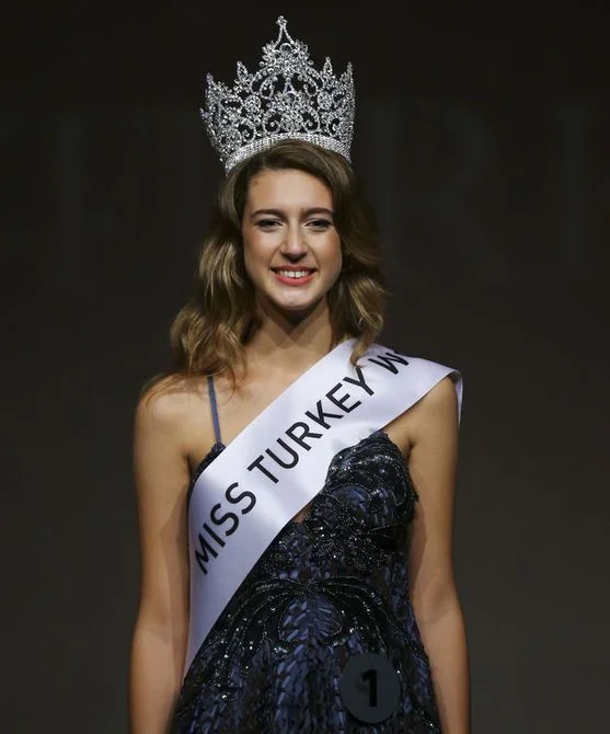 Bir dönem Acun Ilıcalı ile aşk yaşadığı iddia edilen genç model Itır Esen estetik harikası çıktı