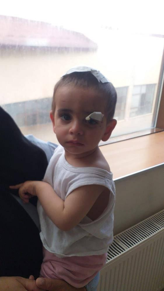 Ağrı'da sokak köpeklerinin saldırdığı 2 yaşındaki Ali Asaf'tan acı haber