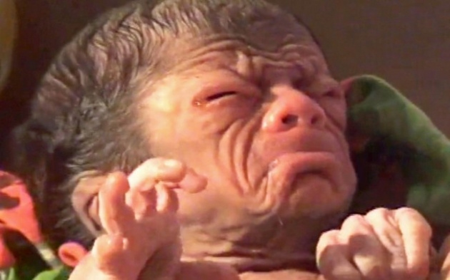 İşte gerçek Benjamin Button!