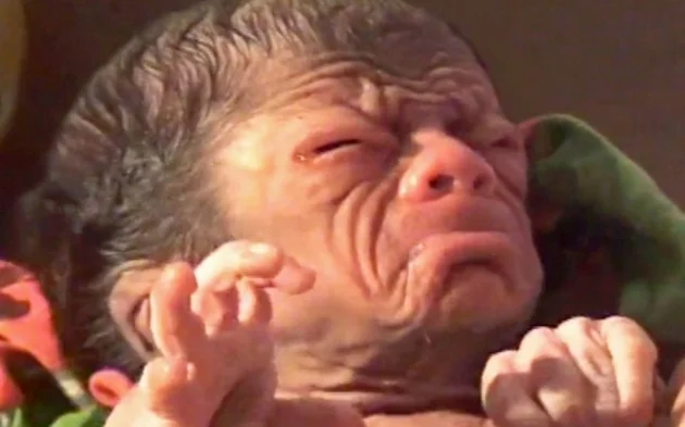 İşte gerçek Benjamin Button!