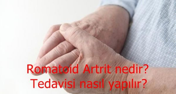 752x395-romatoid-artrit-hastalari-nasil-beslenmeli-1491569865199