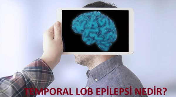 epilepsi_nedir